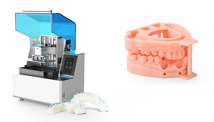 3D Printing Casts, Braces & Orthotics